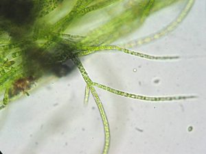Agua de estanque bajo el microscopio