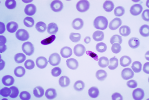 Blood smear of the Plasmodium falciparum parasite.Credit:Content Providers(s): CDC/Dr. Mae Melvin Transwiki approved by: w:en:User:Dmcdevit [Public domain], via Wikimedia Commons