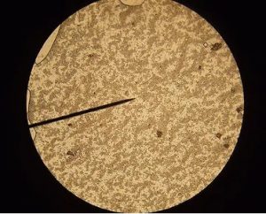 Células de levadura bajo el microscopio-Características, hábitat, observación